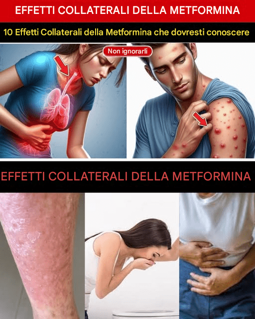 10 effetti collaterali della metformina che pochi pazienti si aspettano di notare