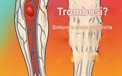 Trombosi: cos’è, come riconoscere i sintomi e come prevenirla in modo naturale