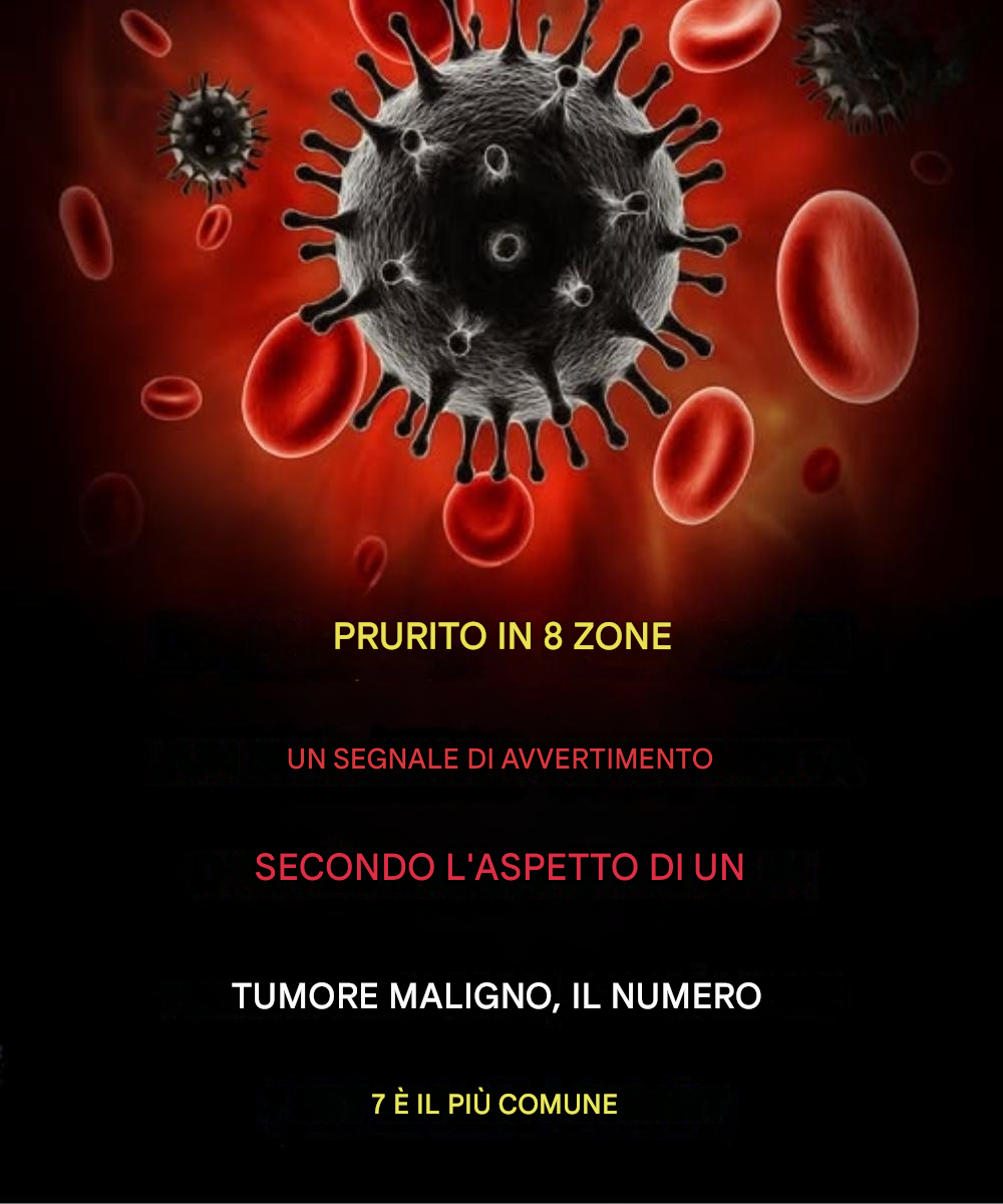 Prurito in 8 aree: un segnale di allarme di tumori maligni, con l’area n. 7 che è la più comune