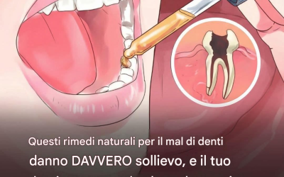 Vuoi sbiancare i denti a casa? Con questo consiglio puoi!