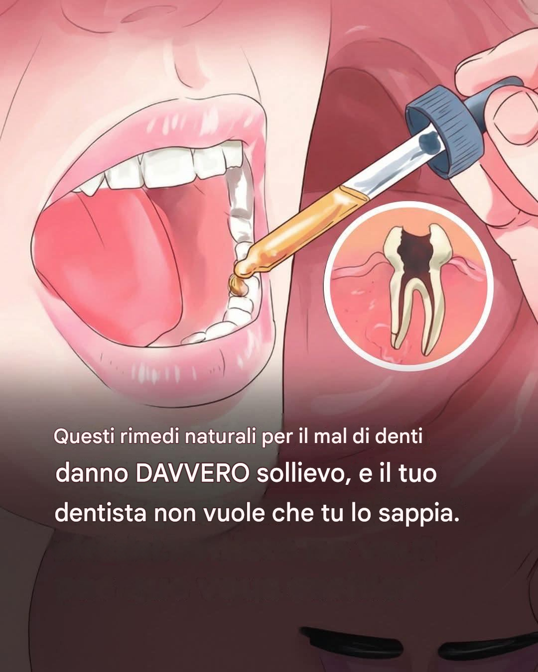 Vuoi sbiancare i denti a casa? Con questo consiglio puoi!