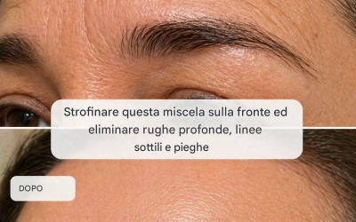 Strofinate questa miscela sulla fronte e liberatevi di rughe profonde, linee sottili e pieghe.