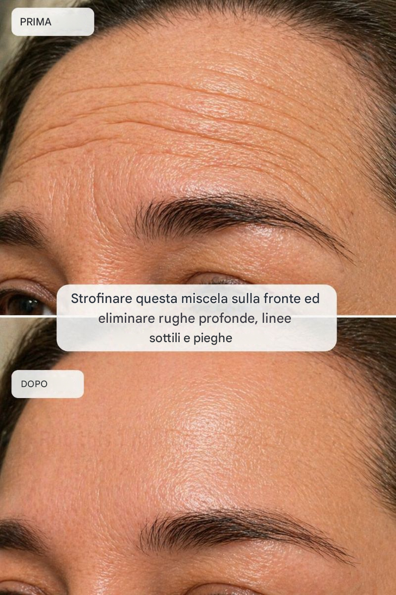 Strofinate questa miscela sulla fronte e liberatevi di rughe profonde, linee sottili e pieghe.