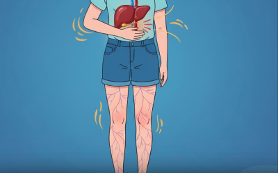 Quando le tue gambe chiedono aiuto: 5 cose importanti a cui prestare attenzione