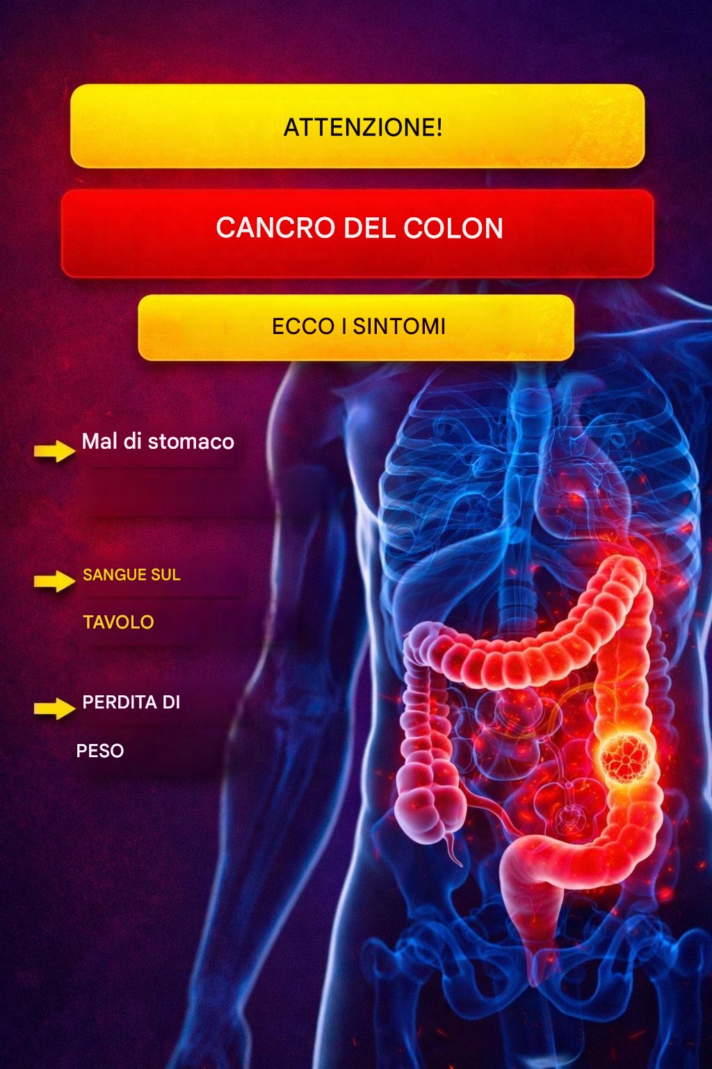 Cancro al colon: la patologia che ha colpito James Van Der Beek: i sintomi a cui prestare attenzione (1/2)