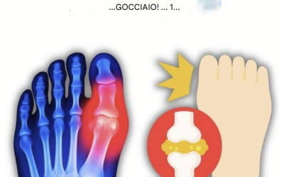“Il mio alluce bruciava… finché non ho scoperto queste 5 bevande che eliminano naturalmente l’acido urico!”