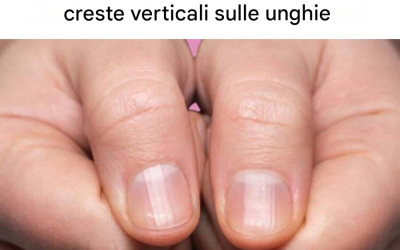 La causa delle creste verticali sulle unghie