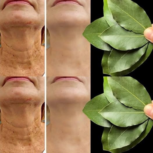 La folha de louro è 100.000 volte più potente del Botox? | Elimina le rughe naturalmente, mesmo aos 70 anos!