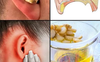 Aglio per la salute delle orecchie: sollievo e protezione naturali