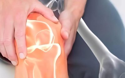 Tumore al pancreas: 4 segnali d’allarme nelle gambe da non ignorare (1/2)