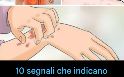 Se i tuoi reni non funzionano correttamente, il corpo ti mostrerà questi 10 segnali.