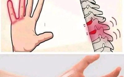 Mani che si addormentano di notte? Parestesia: cause e soluzioni