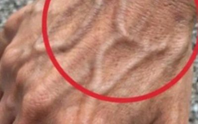 Se hai vene visibili, significa che sei…