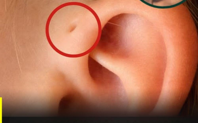 Scopri il significato di questo particolare segno sull’orecchio.