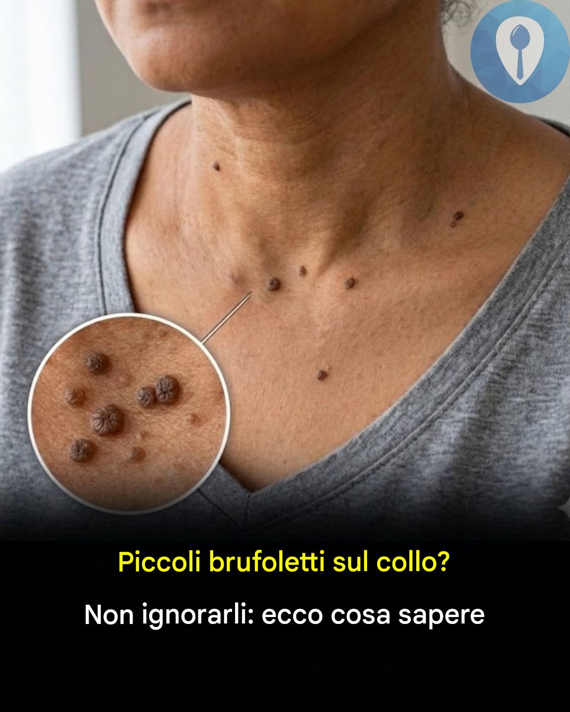 Piccoli brufoletti sul collo? Non ignorarli: ecco cosa sapere