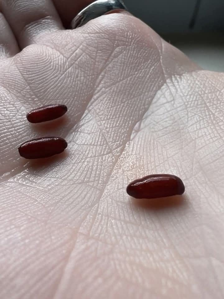 Ho appena trovato questa cosa sul mio letto, mi spaventa un po’, cos’è?