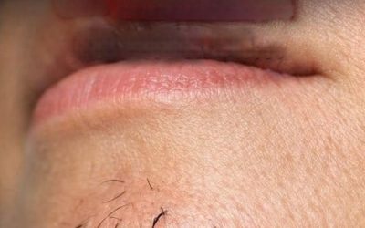 In che modo lo stress e l’alimentazione influenzano la crescita dei peli sul mento nelle donne?