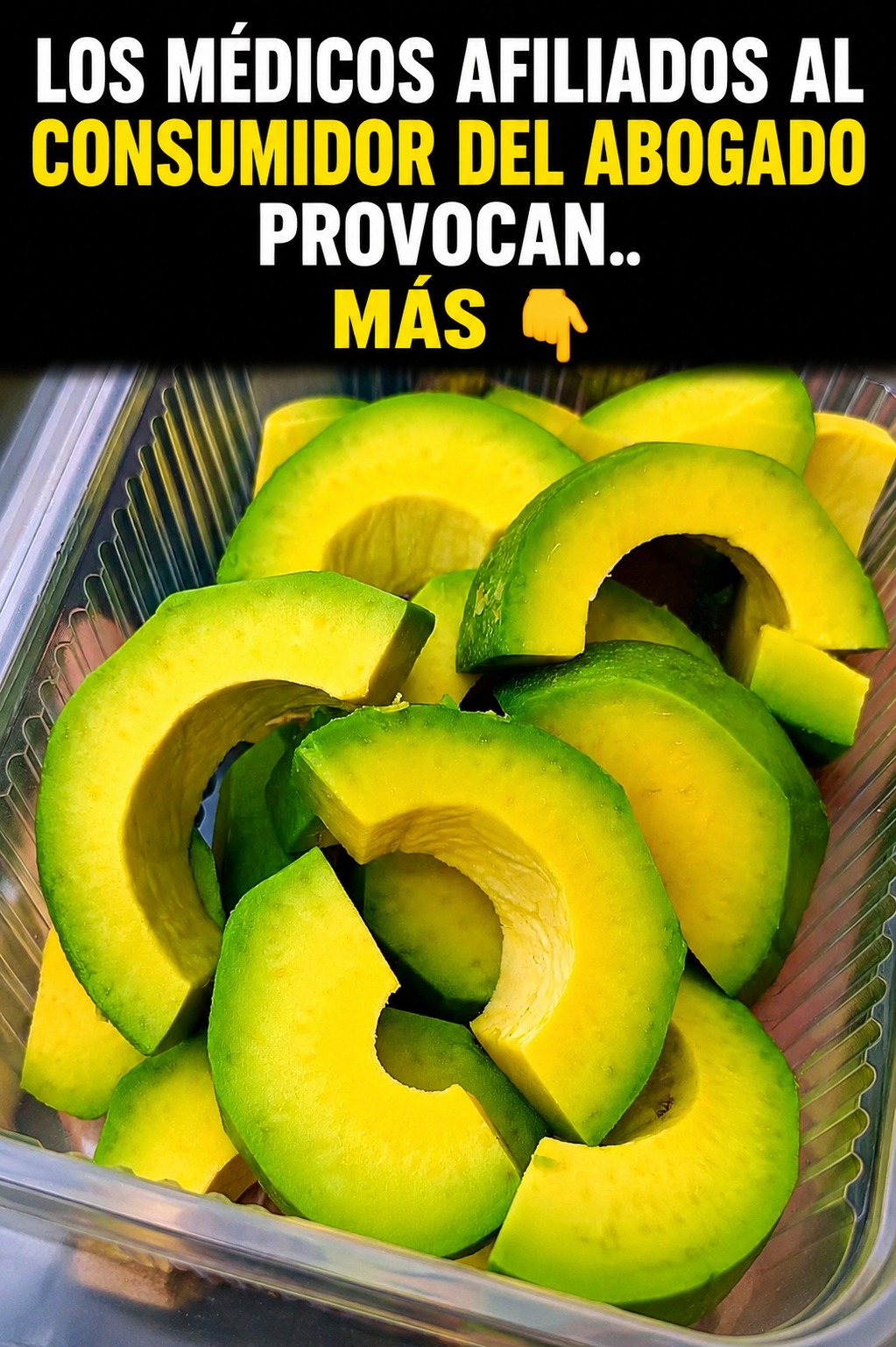 I ben noti benefici per la salute degli avocado… e ciò che sappiamo davvero del loro seme