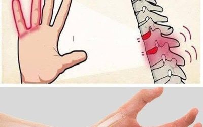 Intorpidimento alle mani: è normale o è sintomo di un problema?