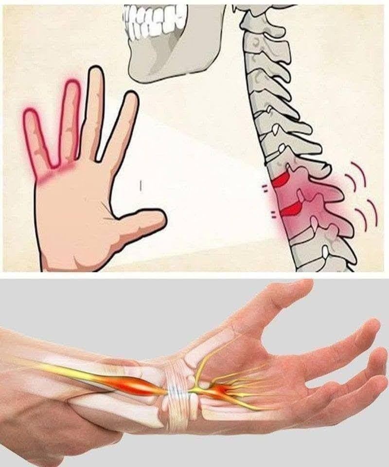 Intorpidimento alle mani: è normale o è sintomo di un problema?