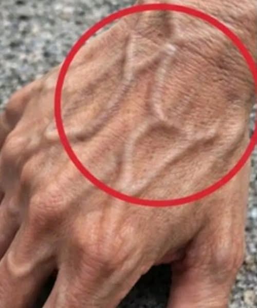 Se hai vene visibili, significa che sei…