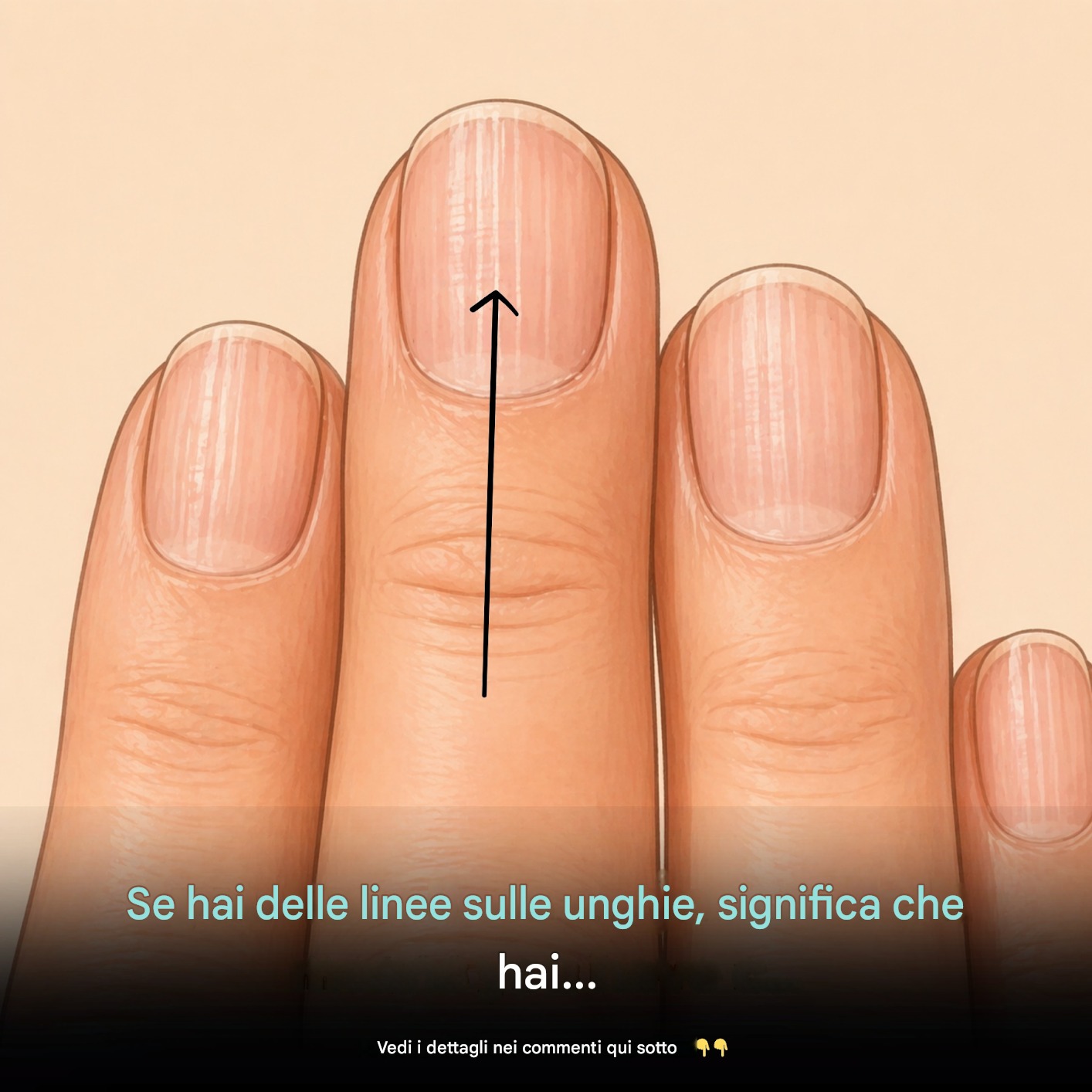 Se hai delle linee sulle unghie, significa che hai…