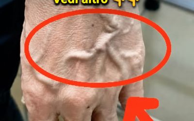 Se le vene di una persona sono visibili, significa che ha una cattiva circolazione?