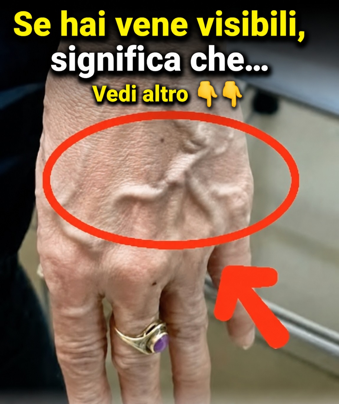 Se le vene di una persona sono visibili, significa che ha una cattiva circolazione?