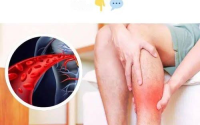 Una vitamina che dilata i vasi sanguigni e migliora la circolazione.