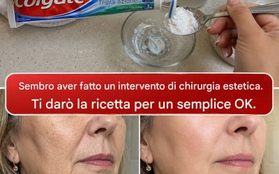 “Sembra che mi sia rifatta”: il rimedio casalingo per migliorare l’aspetto di rughe e macchie scure su mani e braccia. Per continuare a ricevere le mie ricette, basta dire…Grazie!