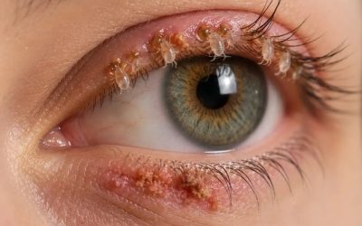 Ecco le conseguenze di dormire con un… Vedi altro