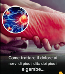 Come trattare il dolore ai nervi di piedi, dita dei piedi e gambe