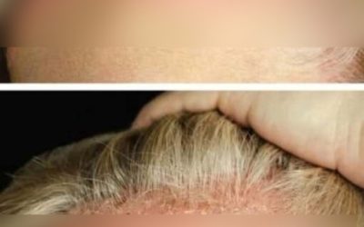 Queste sono le conseguenze del lavarsi con… Vedi altro
