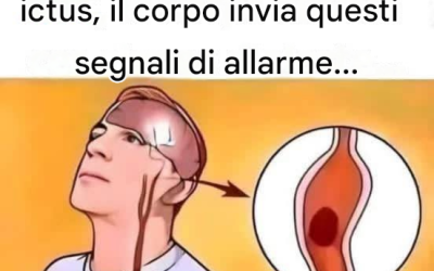 Un mese prima di un ictus, il tuo corpo ti invia questi segnali di avvertimento.