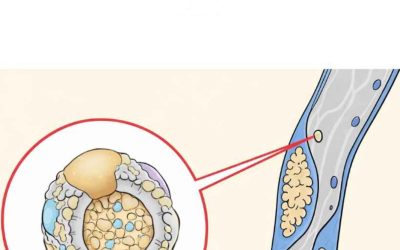5 alimenti che puliscono le arterie in modo naturale