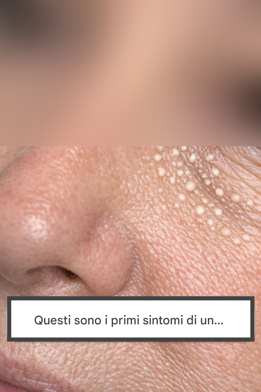 Questi sono i primi sintomi di una…
