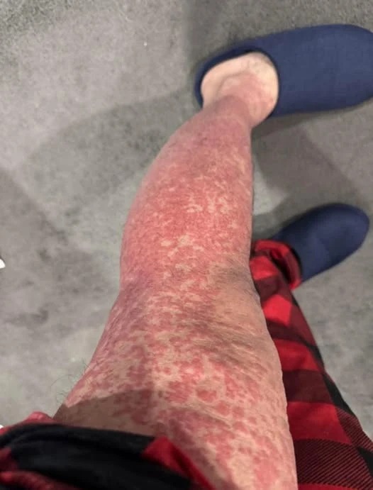 Queste sono le conseguenze di dormire con… Vedi altro